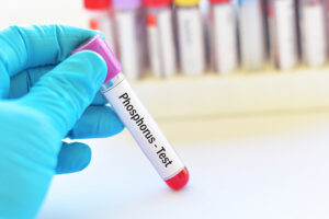 Test de fósforo en sangre