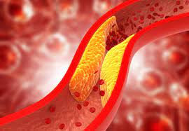 Entrenamiento HIIT y colesterol en sangre
